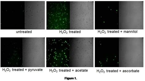 A H 2 DCFDA Loaded Cells Under Confocal Microscope After H 2 O 2