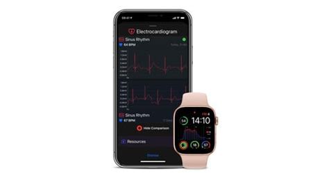 Heart Analyzer Gains Blood Oxygen Saturation Support With Apple Watch