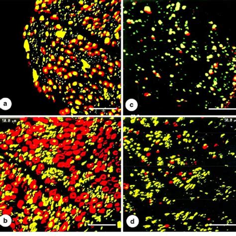 Double Label Immunofluorescence Of Myelin Sheaths And Axons In Sural Download Scientific