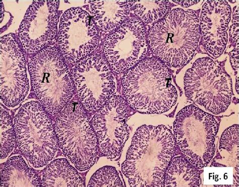 A Photomicrograph Of A Section Of The Testis Of A Control Adult Group