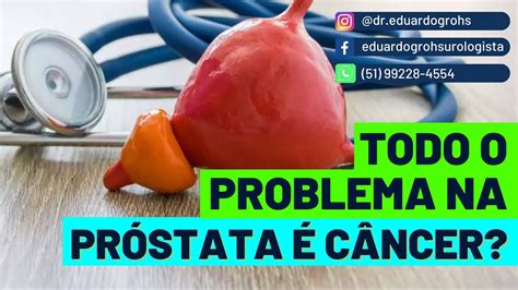 Todo Problema Na Pr Stata C Ncer Dr Eduardo Gr Hs Youtube