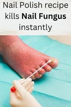 How To Help A Toenail Grow Back Quickly Steps With Pictures Artofit