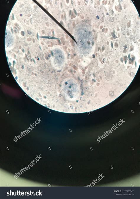 Entamoeba Histolytica Trophozoite Stage Light Microscope Foto Stock Editar Agora 1177765747