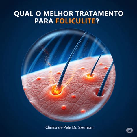 Melhor Gillette Para Foliculite - Qual O Melhor Tratamento Para Foliculite? - O Melhor Tratamento Em 2026