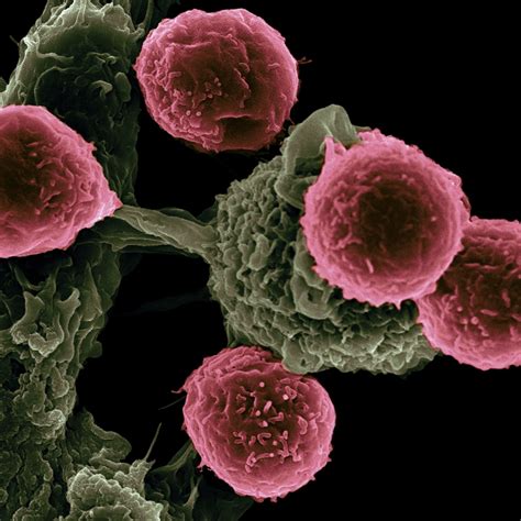 Beware These Five Rare Cancers | Science Times