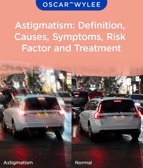 Astigmatism Definition Causes Symptoms Risk Factor And Treatment