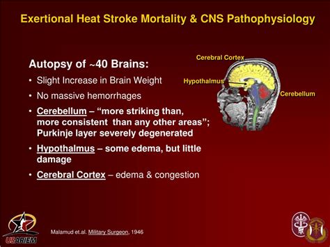 Ppt Exertional Heat Stroke And Pathophysiology Powerpoint Presentation Id325182