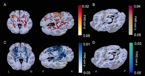 Extensive Network Of White Matter Microstructure Integrity Is Related