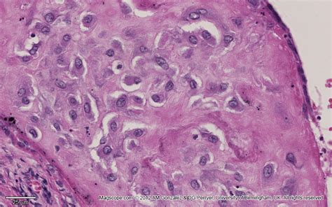 Normal Placenta Histology