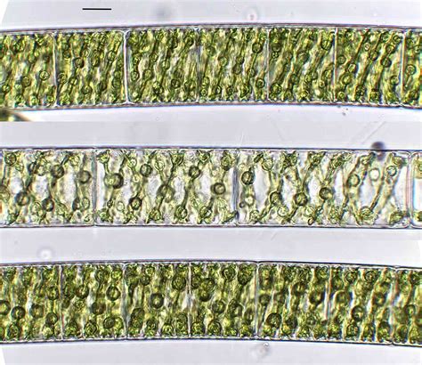 Spirogyra Under Microscope Labeled