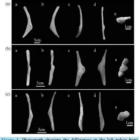 Figure 3 From Sexual Dimorphism In Pelvic Bone Shape Of The North