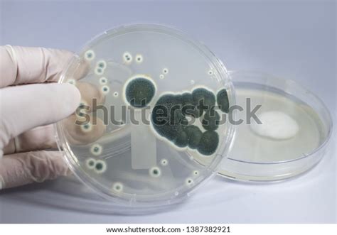 Colonies Penicillium Fungi Grown On Sabouraud Stock Photo 1387382921