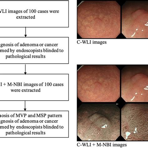 Flow Chart Of Endoscopic Diagnosis Download Scientific Diagram