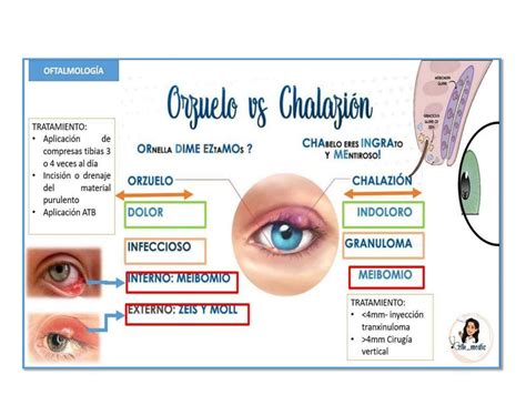 Orzuelo y Chalazión Belk Medic uDocz