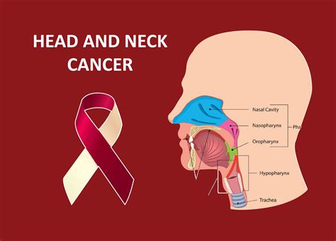 Neck Cancer Stages