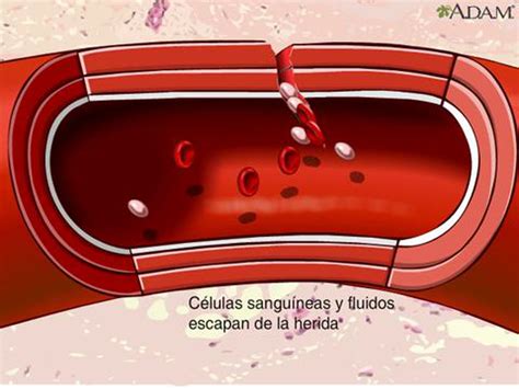 Cómo es el proceso de coagulación de la sangre