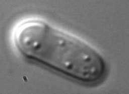 S. pombe yeast cell, picture taken with DIC microscopy. The lipid... | Download Scientific Diagram