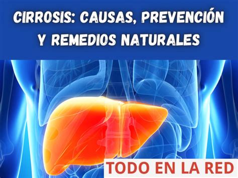 Cirrosis causas prevención y remedios naturales Todo en la red