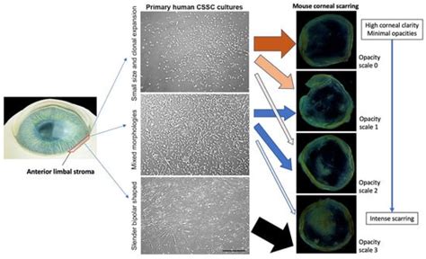 Ijms Free Full Text Combined Therapy Using Human Corneal Stromal