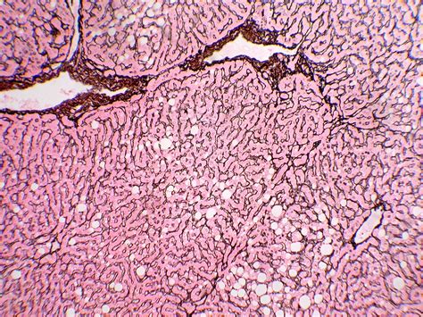 Reticulum - Histology Control Systems, Inc