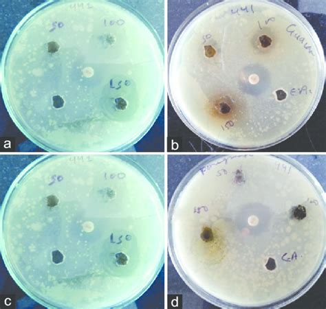 Antibacterial activity shown by leaves extracts of fruits plants on ...