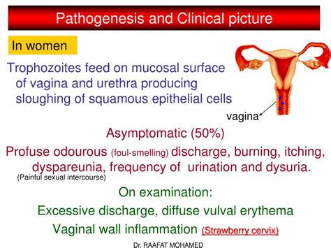 Ppt Trichomonas Vaginalis Powerpoint Presentation Free Download Id3013018