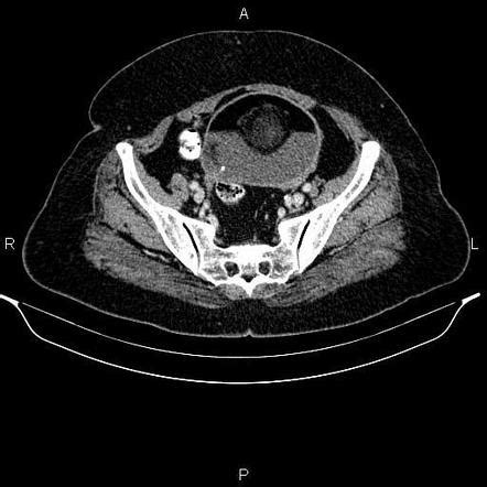 Radiology Quiz Radiopaedia Org