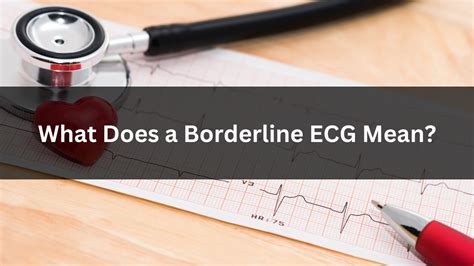 What Does A Borderline Ecg Mean What You Need To Know