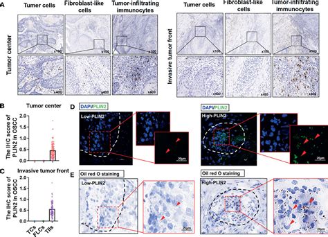 Frontiers Lipid Droplet Related Plin In Cd Tumor Associated