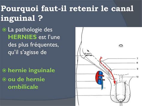 Ppt La Cavite Abdominale Et Ses Parois Powerpoint Presentation Free