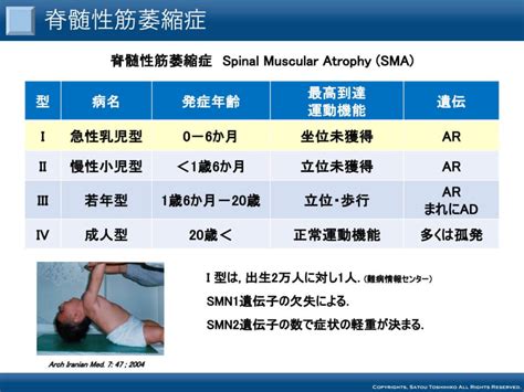 パーキンソン病などの神経難病の治療に期待が高まる「遺伝子治療」の最前線 セカンドオピニオン情報サイト