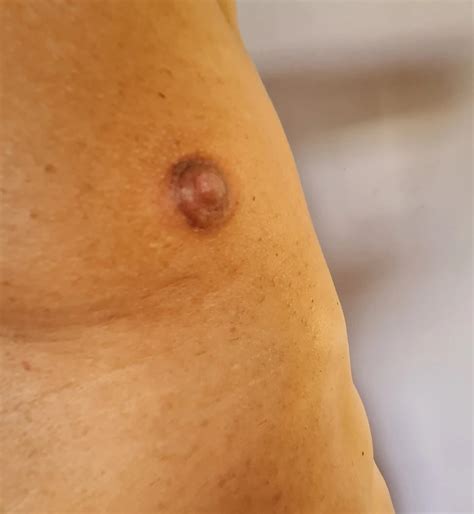 NIPPLES PUMPED ESSION 2 42 Nude Pics XHamster