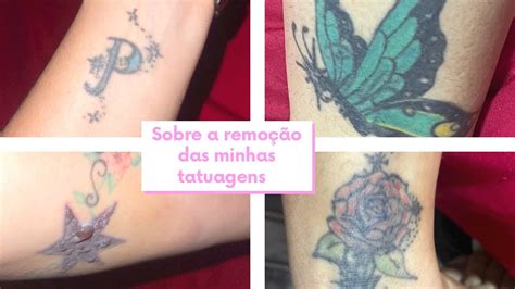 SOBRE A REMOÇÃO DAS MINHAS TATUAGENS YouTube