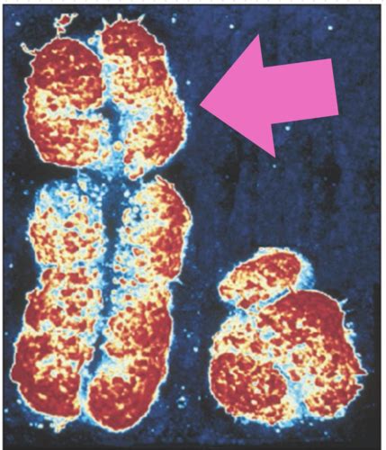 Chapter Matters Of Sex Flashcards Quizlet