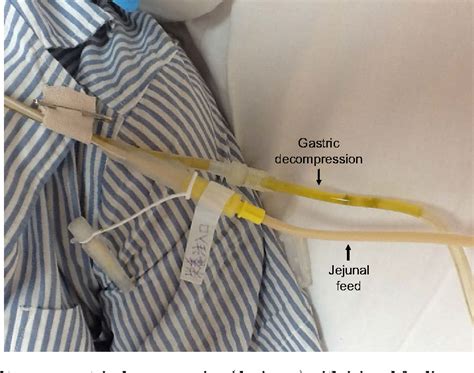 Figure 4 From Maintaining Enteral Nutrition In The Severely Ill Using A