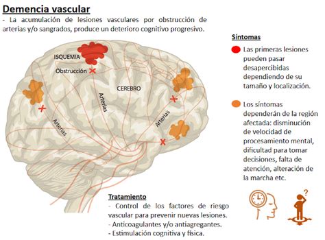 Demencia Vascular Clínica Josefina Arregui