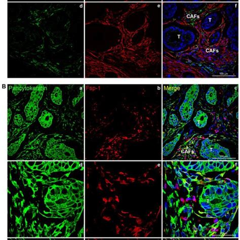 Mesothelial Derived Cafs Co Express Mesothelial And Mesenchymal Markers