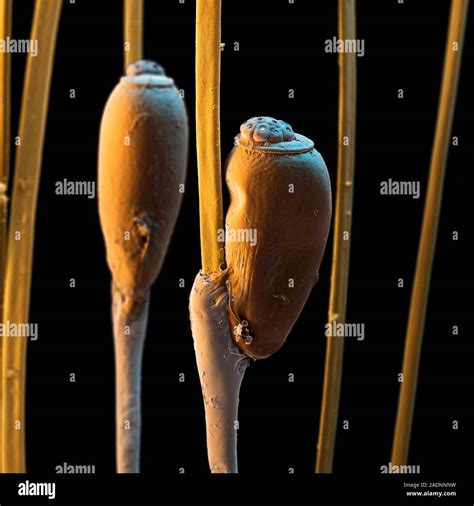 Head louse nits. Coloured scanning electron micrograph (SEM) of two ...