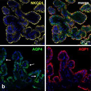 Expression Of Aqp And Aqp In The Human Choroid Plexus A A Cp Villus