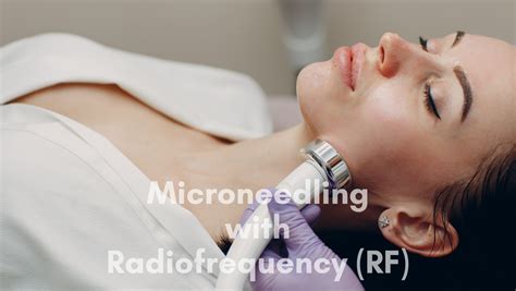 Rf Microneedling Vs Traditional Microneedling Made Easy Replenish