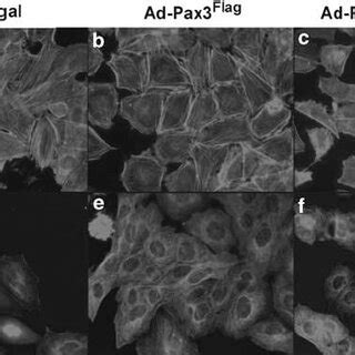 Pax3 And Pax3 FKHR Binding To The 5 0 Region Of Gene Targets Pax3 A