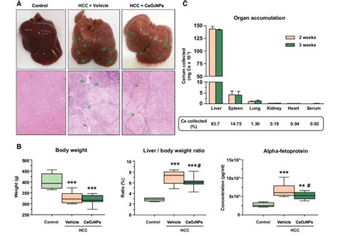 DEN Induced Model Of HCC And Biodistribution Of CeO 2 NPs A