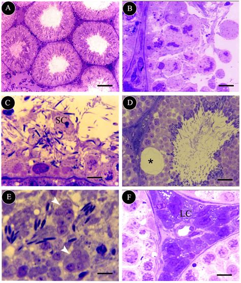 Tbo Stained Semi Thin Sections Of Testis Of Control A And Qae