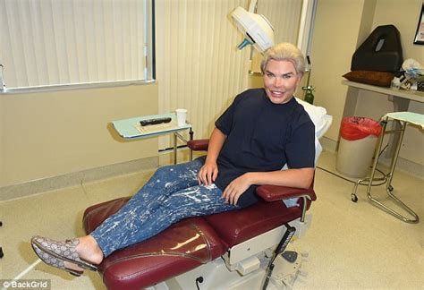 Human Ken Doll Rodrigo Alves Gets A Hair Transplant Daily Mail Online