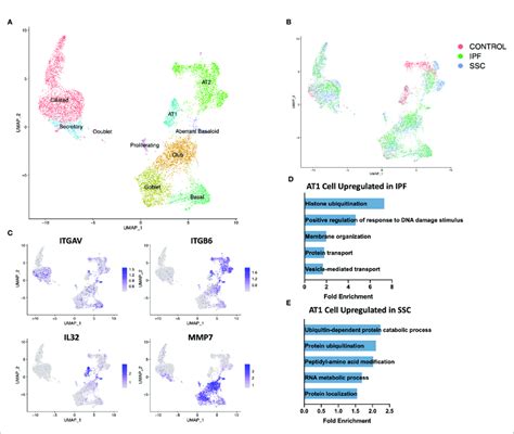 Scrna Seq Analysis Of Ipf Ssc Ild And Control Epithelial Cell