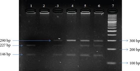 Representative Gel Showing PstI Digested Amplicons Of XPD Codon 751 Run