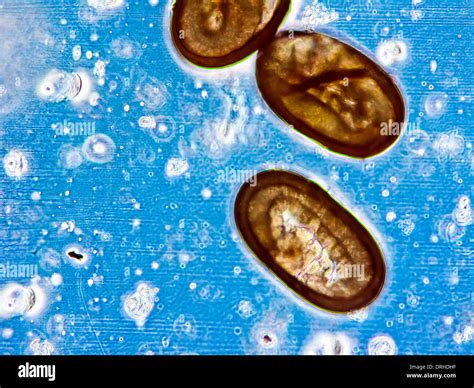 Microscopic view of a cat flea eggs Stock Photo - Alamy