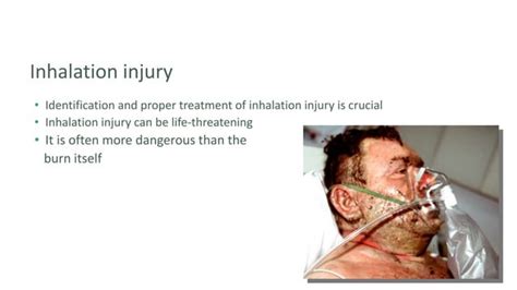 Thermal Injuries Or Thermal Burnpptx