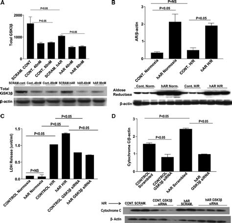 Gsk Small Interfering Rna Sirna Knock Down In Hl Cells Western