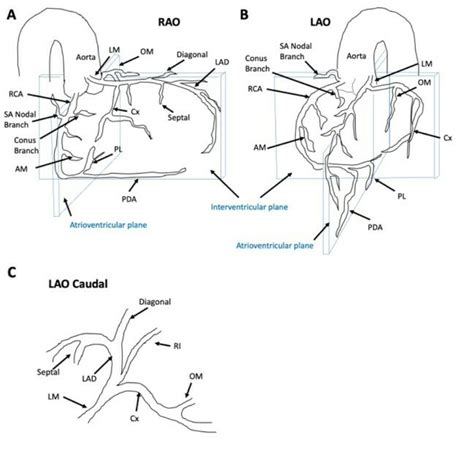 Coronary The American Association For Thoracic Surgery Aats